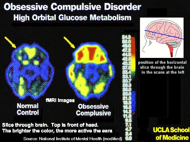 The Science of Exposure and Response Prevention ERP Obsessive Compulsive Disorder OCD Brain Anxiety CBT Your Anxiety Toolkit Podcast Kimberley Quinlan